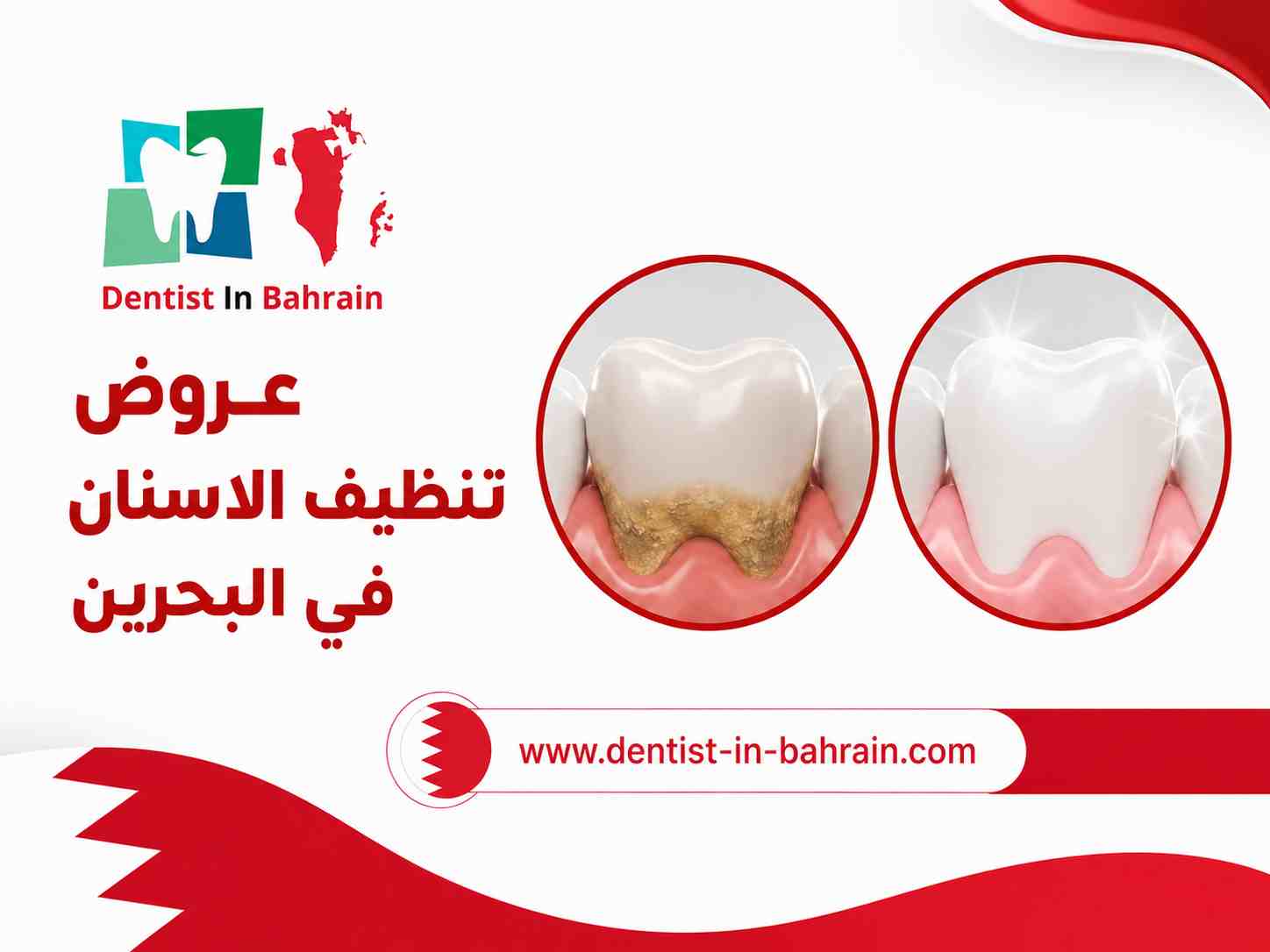 عروض تنظيف الاسنان في البحرين
