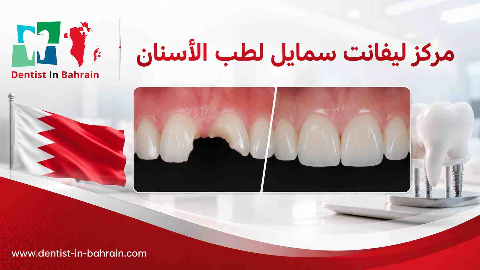 مركز أس بي أيسمايل لطب الأسنان